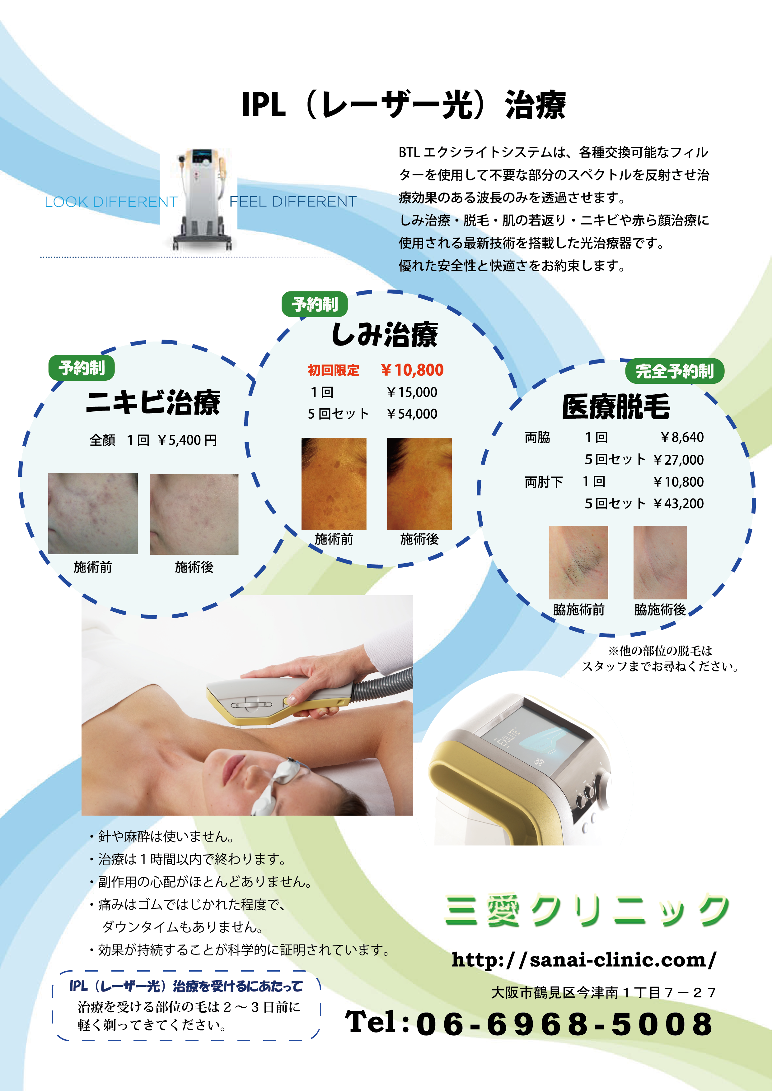 IPL（レーザー光）治療